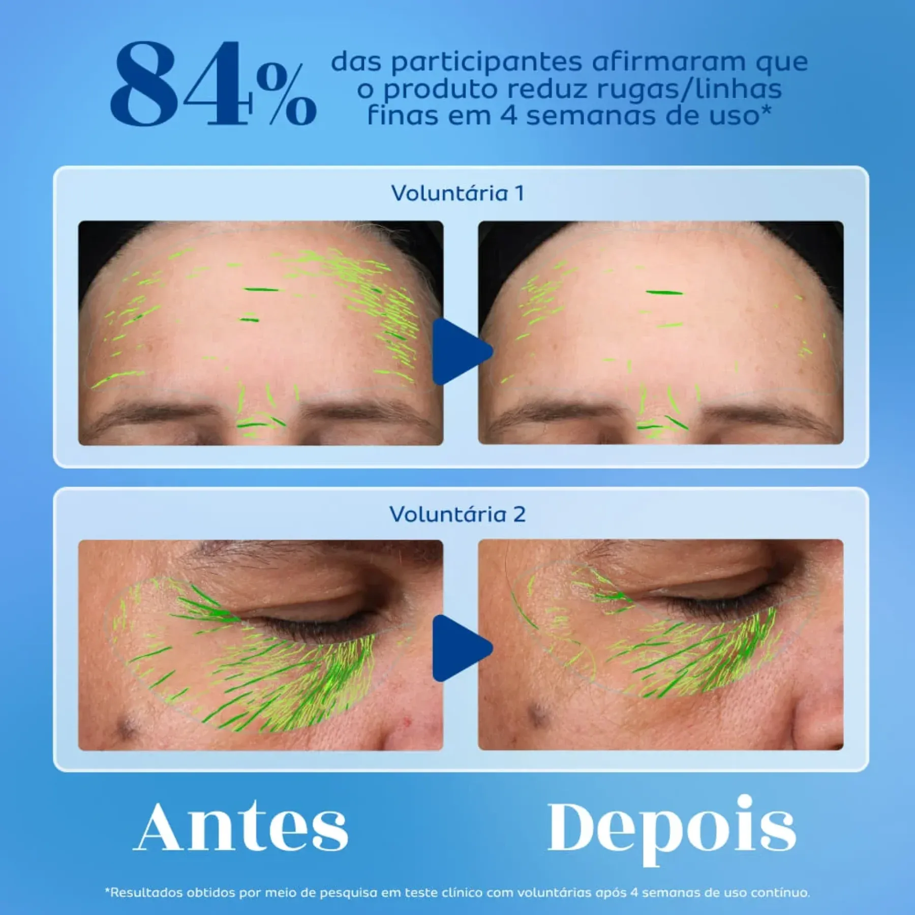 MONANGE FACIAL -3-